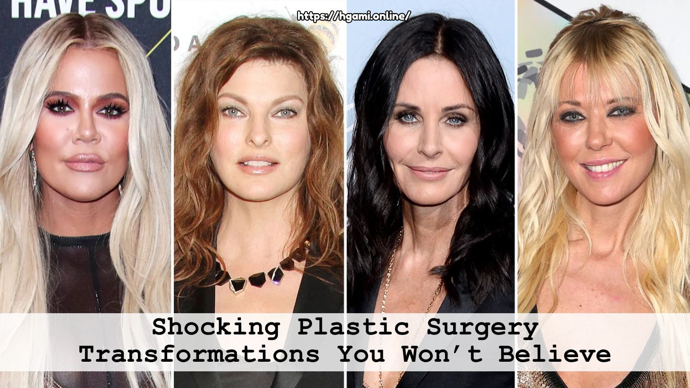 Shocking Plastic Surgery Transformations You Won’t Believe